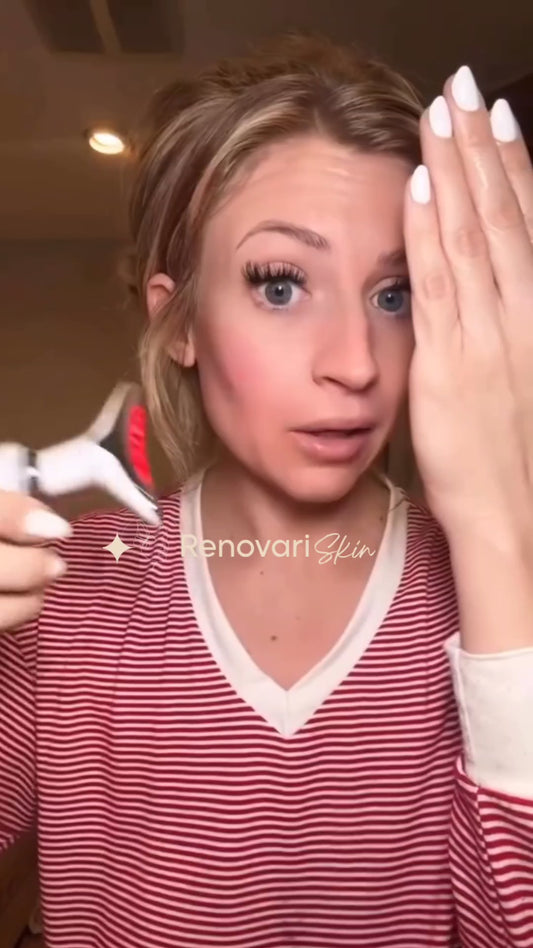 Removedor Avançado - Led Vibração ( Anti-Rugas / Massageador)